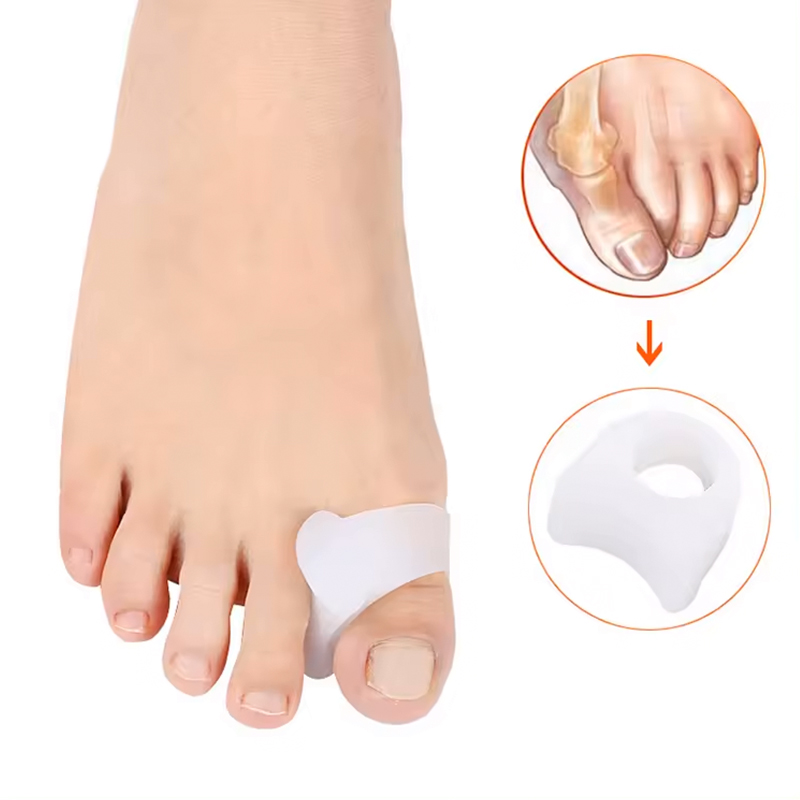 Tåring med tåspreder - 2 stk - Separer tærne ved hallux valgus