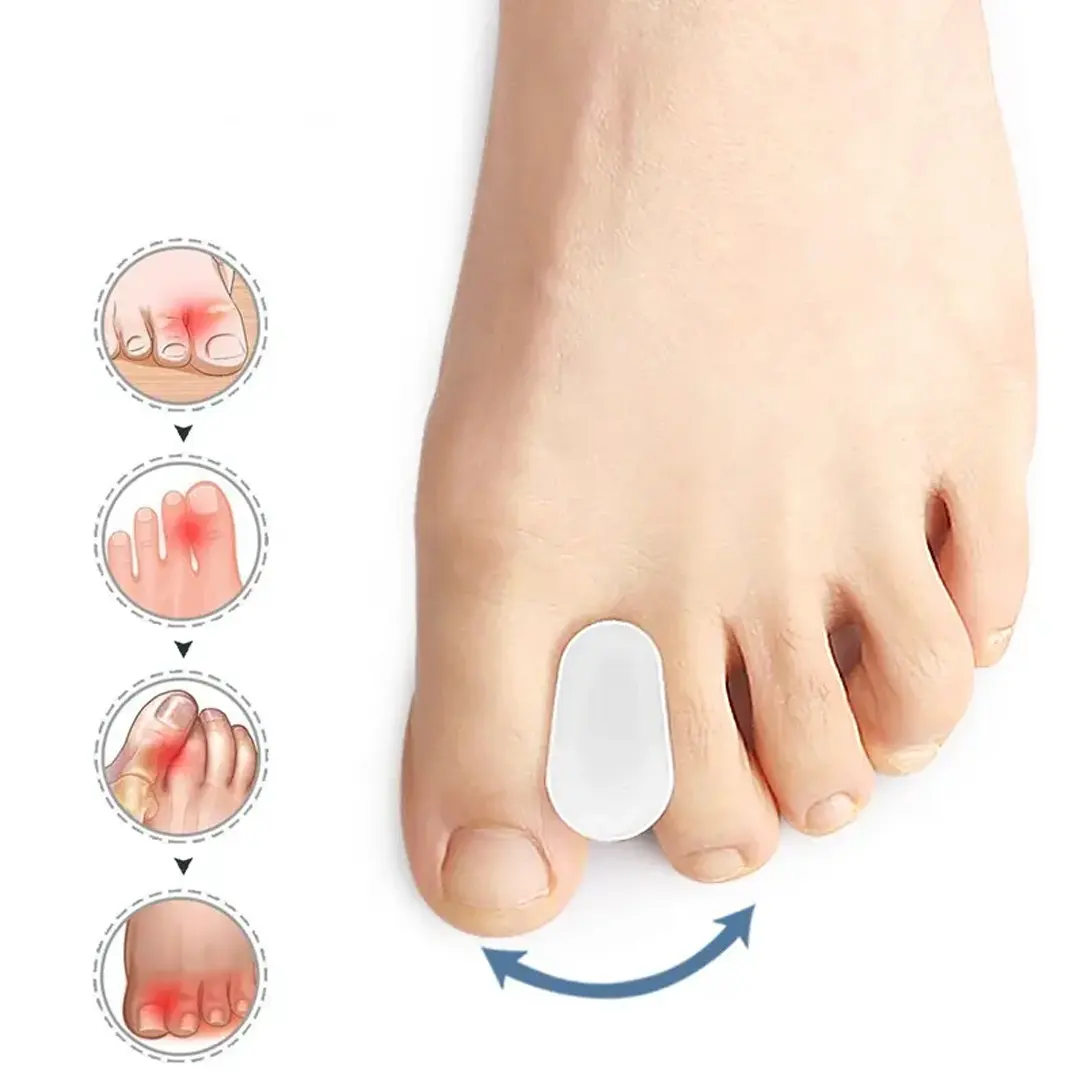 Tåspreder for hallux valgus - 2 stk - Separerer tærne for å redusere smerte