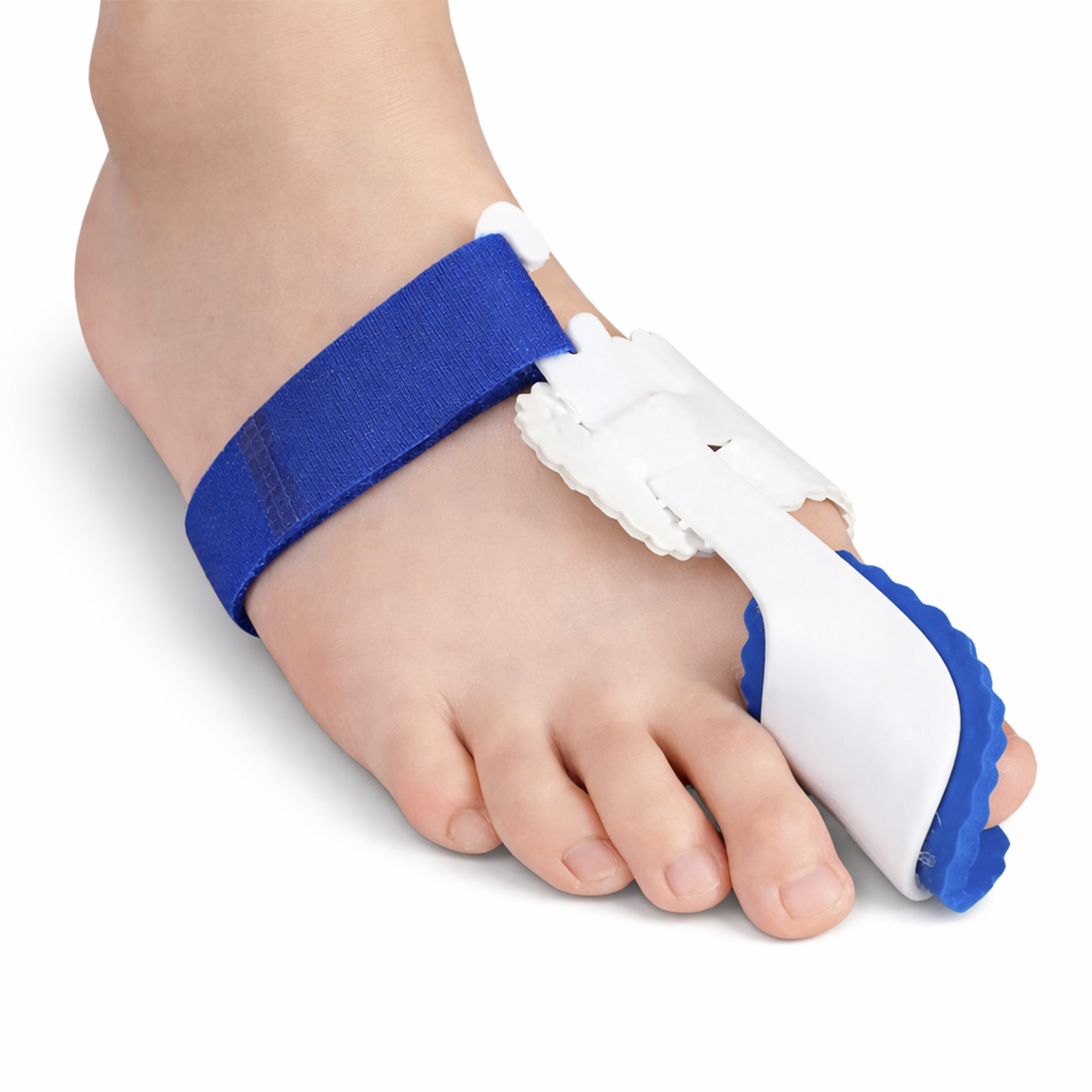 Nattstøtte for hallux valgus - 2 stk - Riktig skjev stortå med nattskinne